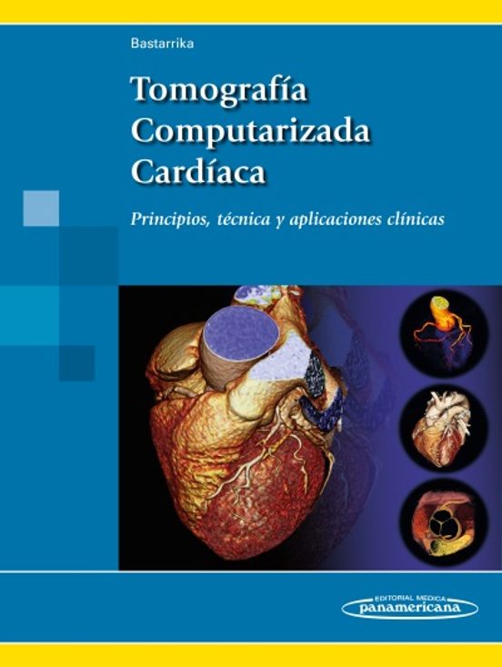 Tomografia Computarizada Cardiaca: Principios Tecnica Y Aplicaciones C