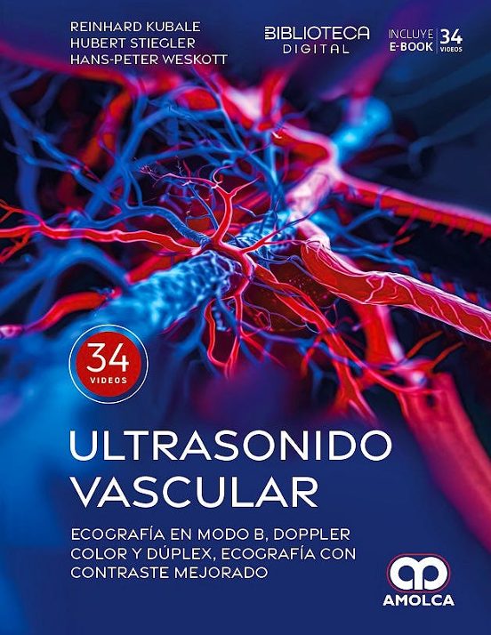 Ultrasonido Vascular. Ecografía En Modo B Doppler Color Y Duplex Ecogr