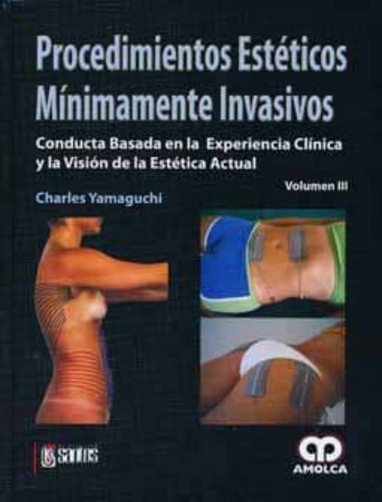 Procedimientos Esteticos Minimamente Invasivos: Conducta Basada E N La
