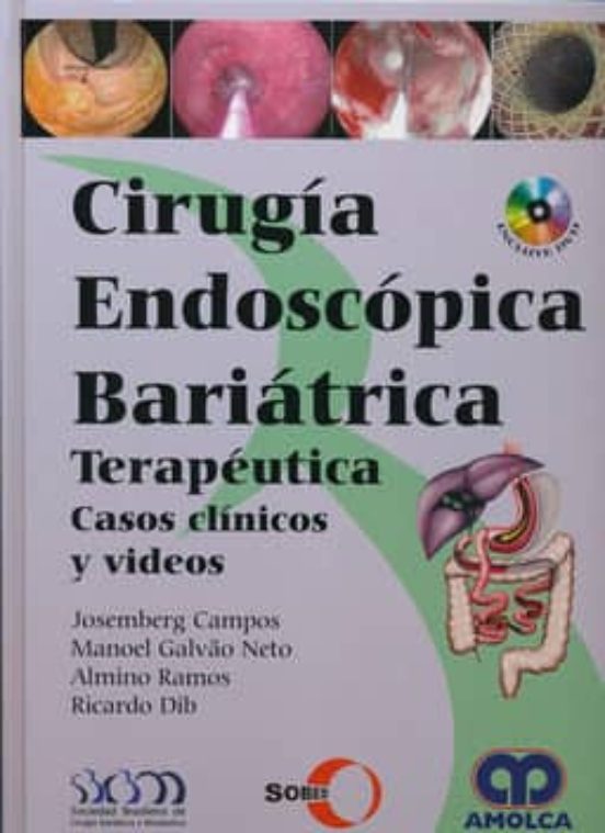 Cirugia Endoscopica Bariatrica Terapeutica
