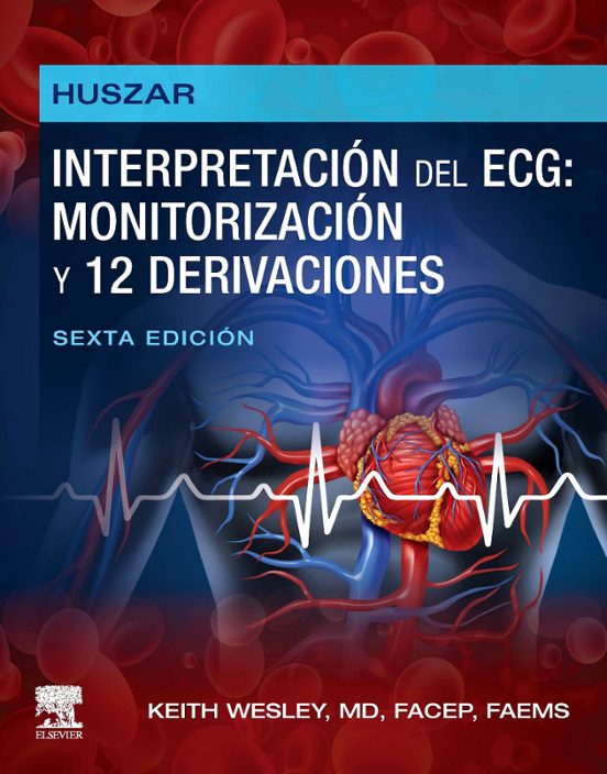 Huszar. Interpretación Del ECG: Monitorización Y 12 Derivaciones