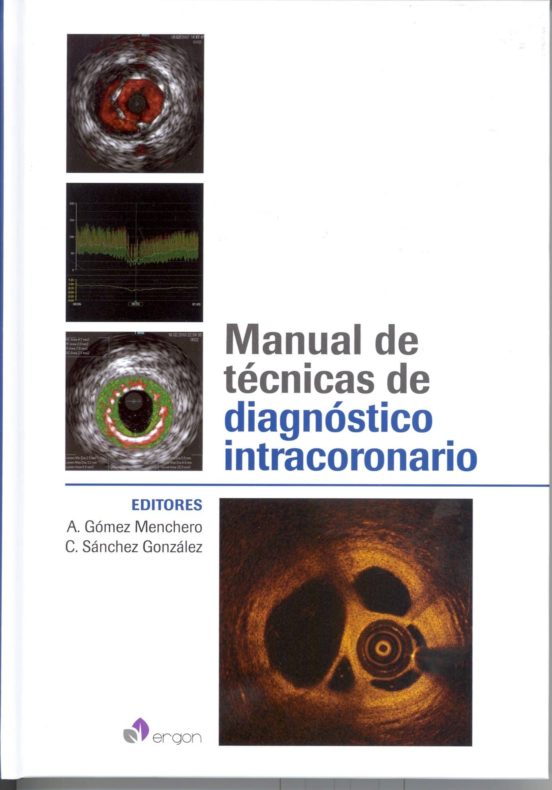 Manual De Técnicas De Diagnóstico Intracoronario
