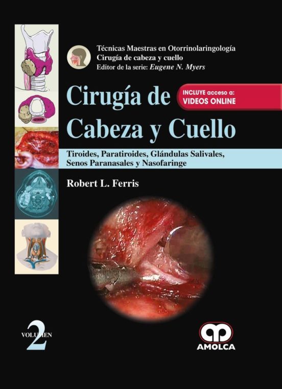Cirugía De Cabeza Y Cuello: Tiroides Paratiroides Glándulas Sal Ivares