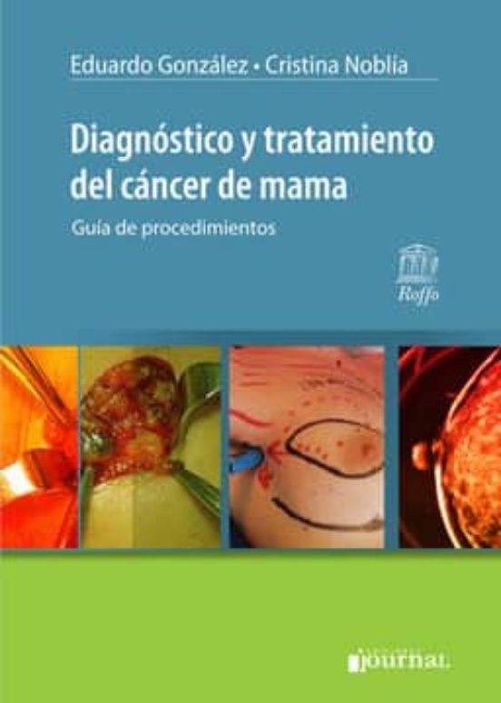 Diagnostico Y Tratamiento Del Cancer De Mama: Guia De Procedimientos