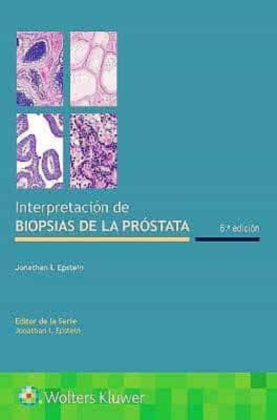 Interpretación De Biopsias De La Próstata