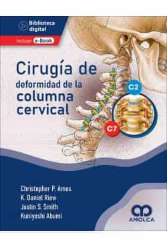 Cirugía De La Deformidad De La Columna Cervical