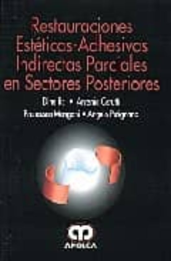 Restauraciones Esteticas-adhesivas Indirectas Parciales En Sector Es P