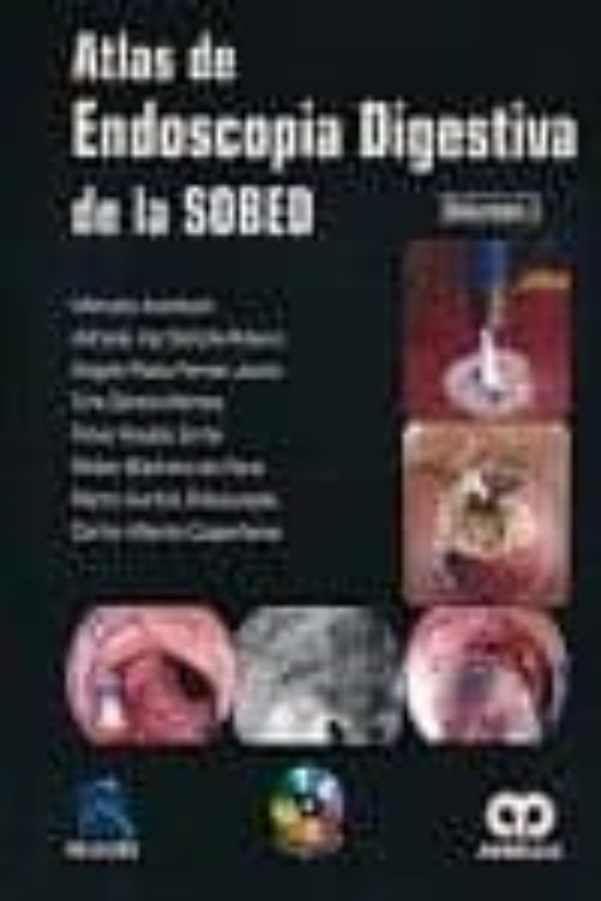 Atlas De Endoscopia Digestiva De La Sobed