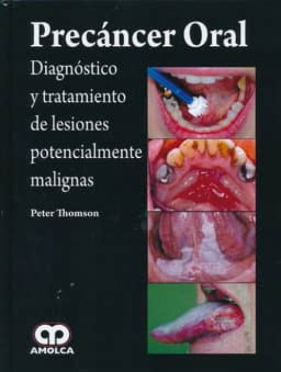 Precancer Oral: Diagnostico Y Tratamiento De Lesiones Potenciales Mali