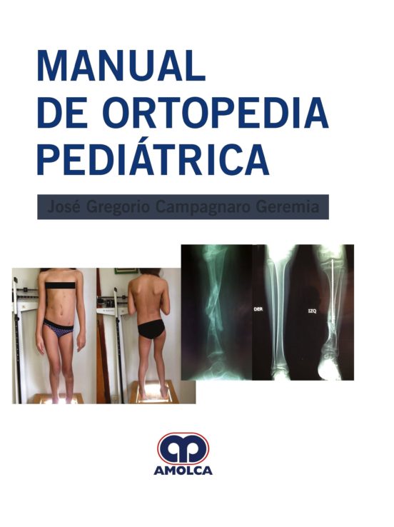 Manual De Ortopedia Pediatrica