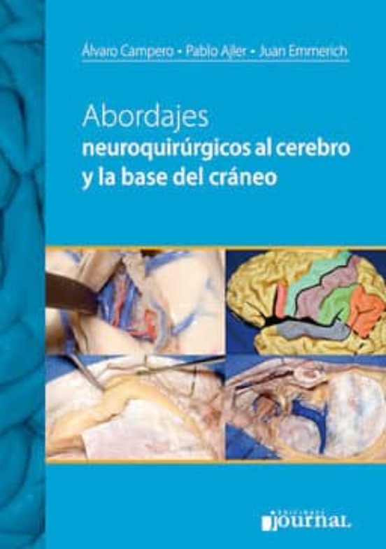 Abordajes Neuroquirurgicos Al Cerebro Y A La Base Del Craneo