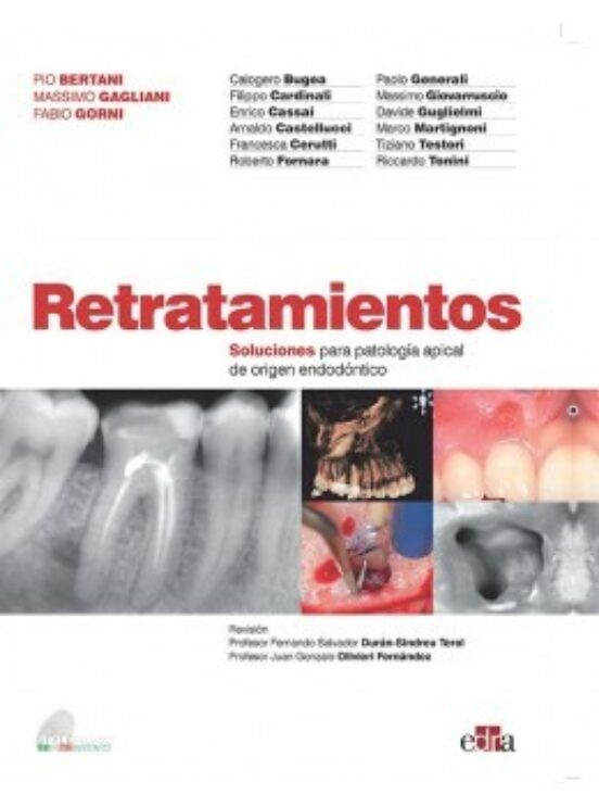 Retratamientos. Soluciones Para Patología Apical De Origen Endodóntico