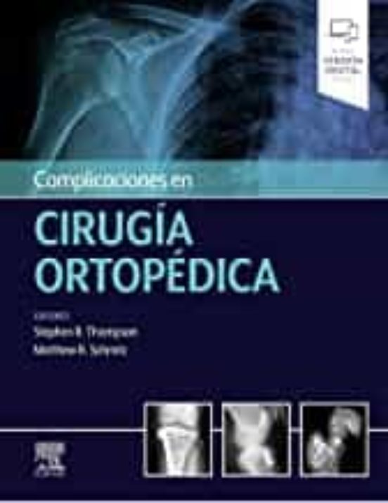 Complicaciones En Cirugía Ortopédica