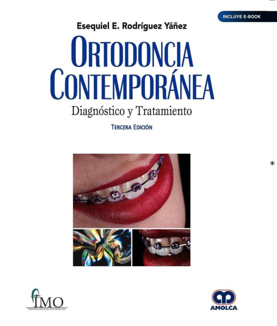 Ortodoncia Contemporánea. Diagnóstico Y Tratamiento