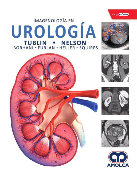 Imagenologia En Urologia + E-book