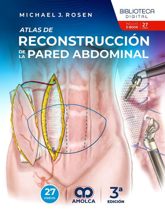Atlas de reconstrucción de la pared abdominal