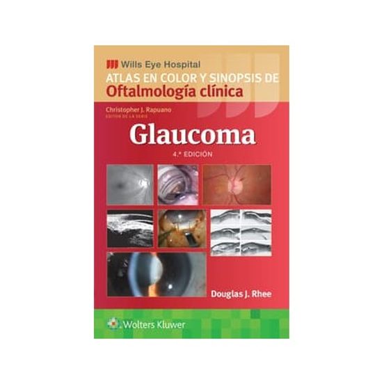 Glaucoma Atlas En Color Y Sinopsis De Oftalmología Clínica De