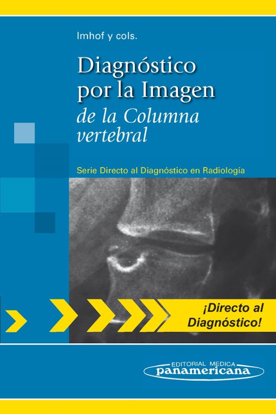 Diagnostico Por La Imagen De La Columna Vertebral