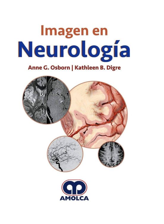 Imagen En Neurologia