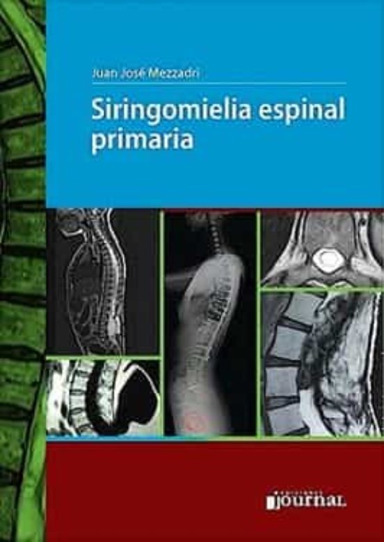 Siringomielia Espinal Primaria