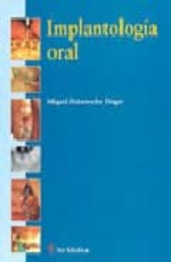Implantologia Oral