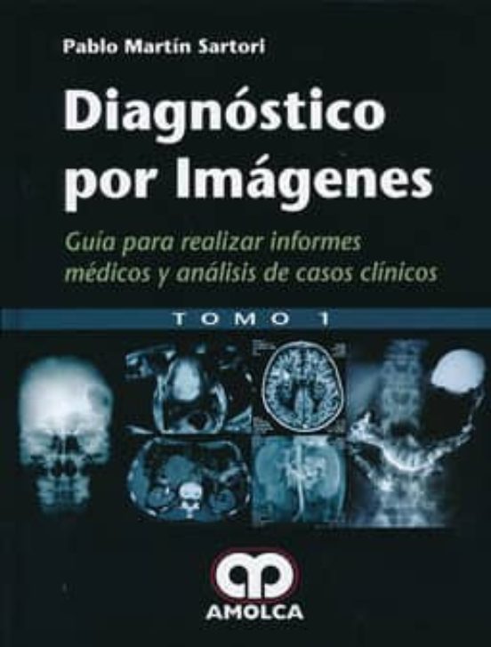 Diagnostico Por Imagenes: Guia Para Realizar Informes Medicos Y Analis