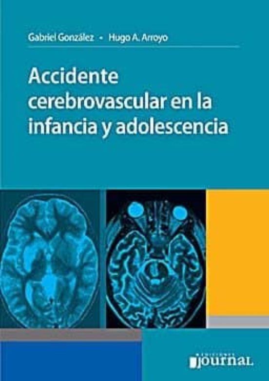 Accidente Cerebrovascular En La Infancia Y Adolescencia