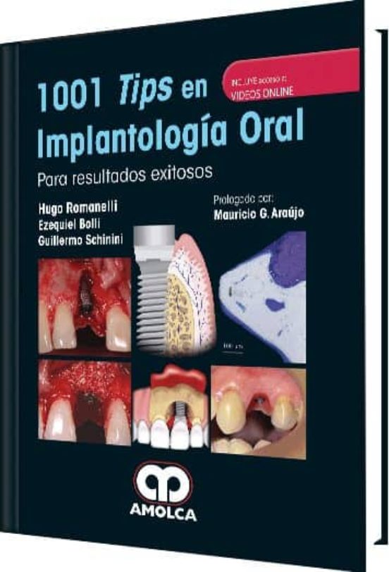 1001 Tips En Implantologia Oral Para Resultados Exitosos + Videos Onli