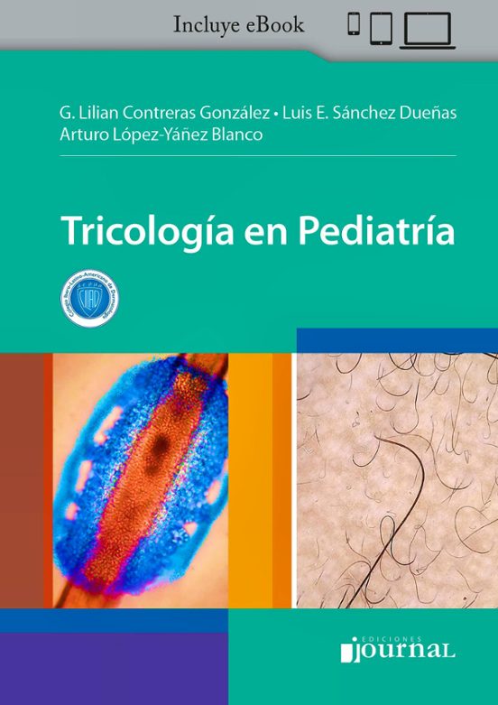 Tricologia En Pediatria