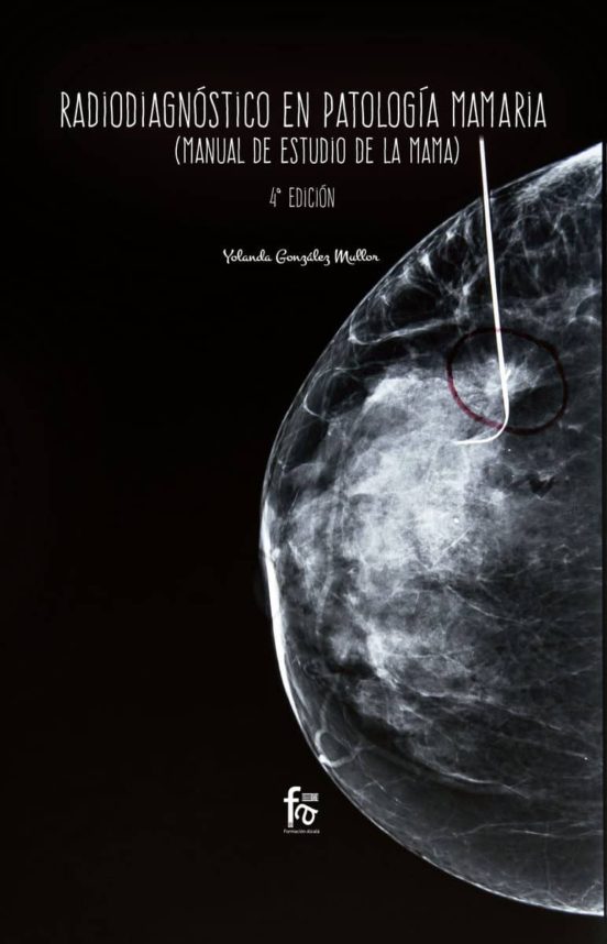 Radiodiagnóstico En Patología Mamaria