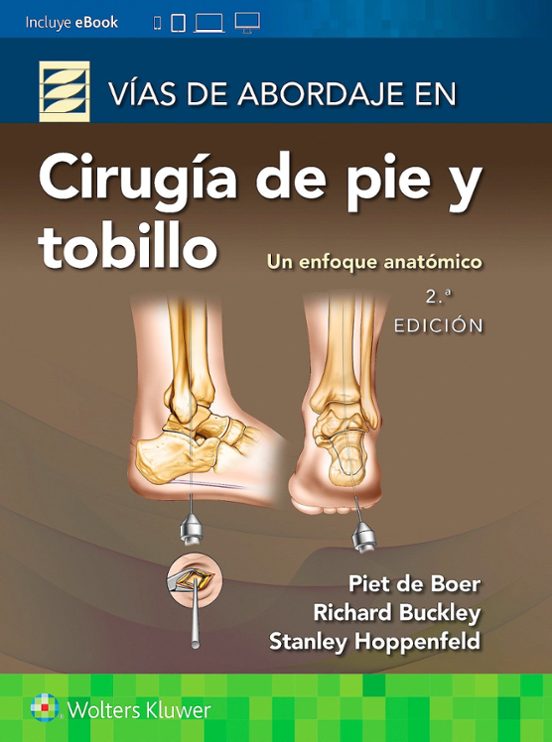 Vías De Abordaje De Cirugía De Pie Y Tobillo