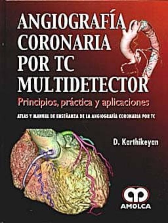 Angiografia Coronaria Por Tc Multidetector: Principios Practica Y Manu
