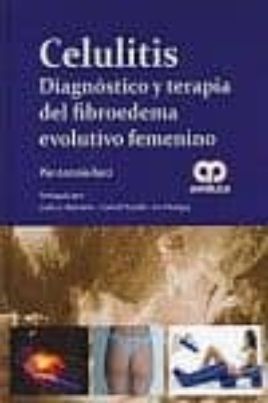 Celulitis: Diagnostico Y Terapia Del Fibroedema Evolutivo Femenin O
