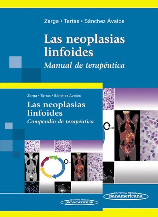 Zerga. Las Neoplasias Linfoides