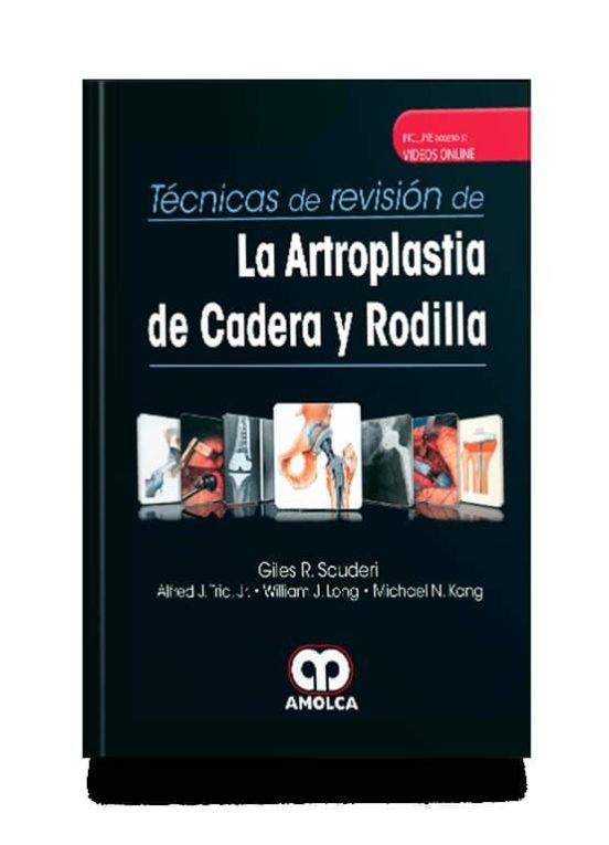 Tecnicas De Revision De La Artroplastia De Cadera Y Rodilla + Videos O