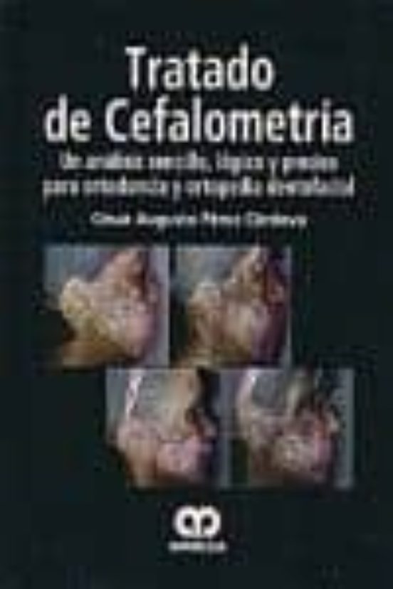 Tratado De Cefalometria: Un Analisis Sencillo Logico Y Preciso P Ara O