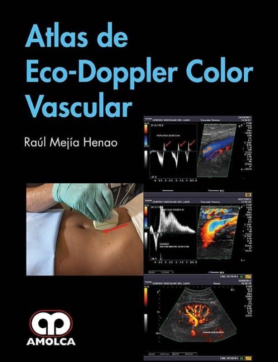 Atlas De Eco-doppler Color Vascular