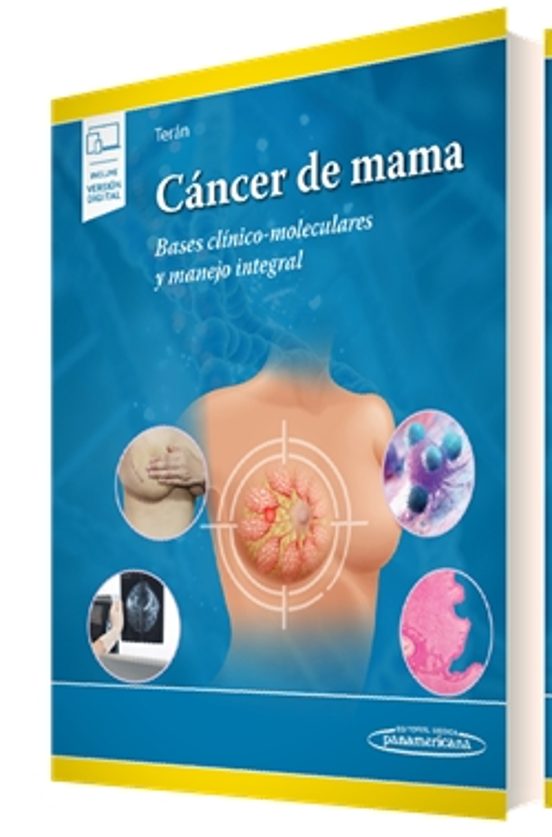 Cáncer De Mama