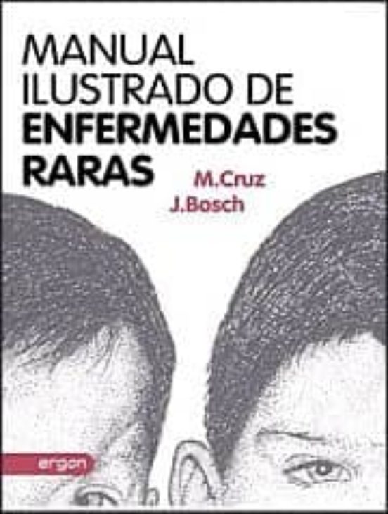 Manual Ilustrado De Enfermedades Raras