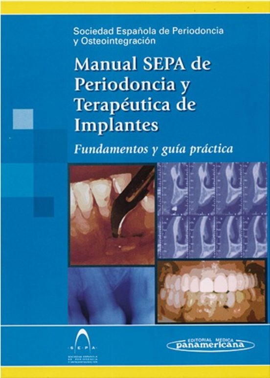 Manual Sepa De Periodoncia Y Terapeutica De Implantes: Fundamento S Y