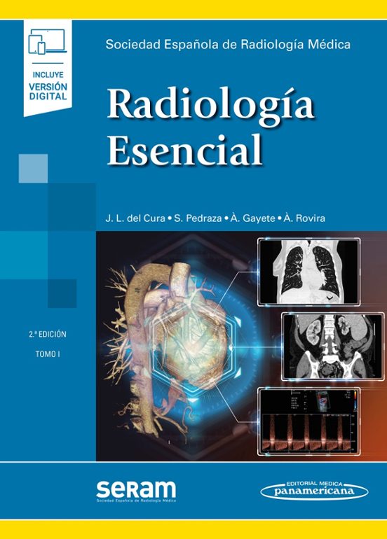 Radiología Esencial 2 Volumenes