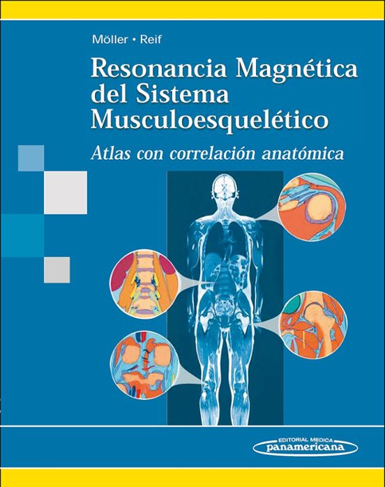 Resonancia Magnetica Del Sistema Musculoesqueletico. Atlas Con Co Rrel