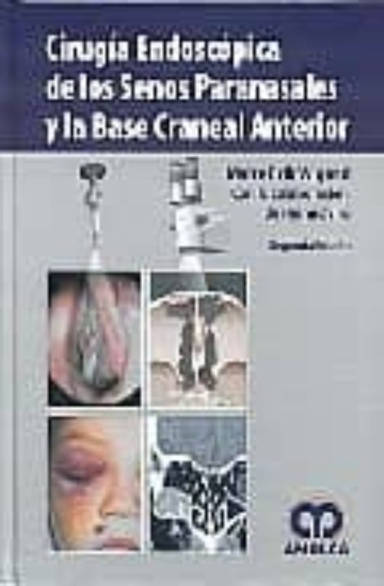 Cirugia Endoscopica De Los Senos Paranasales Y La Base Craneal An Teri