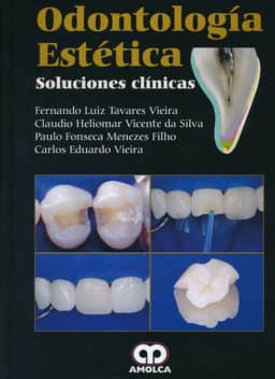 Odontologia Estetica. Soluciones Clinicas