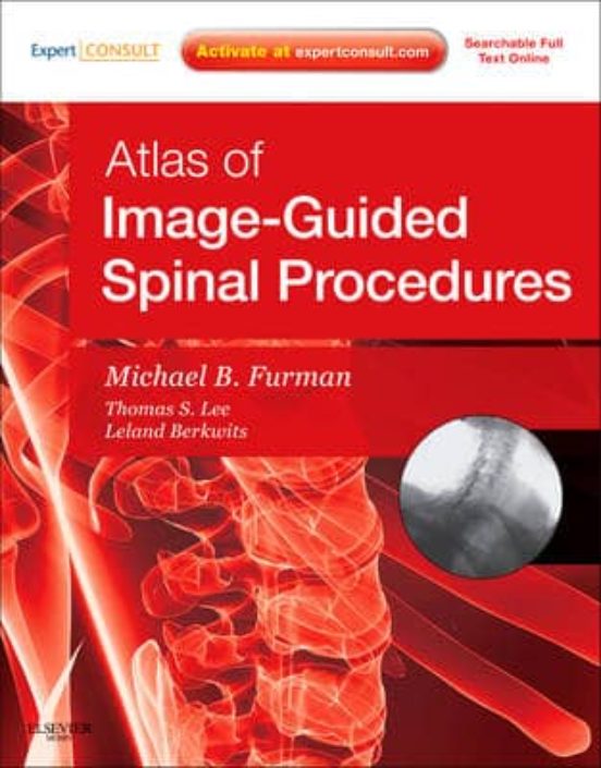 Atlas Of Image - Guided Spinal Procedures Expert Consult - Onlin E And