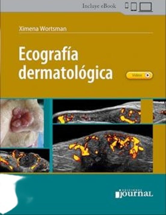 Ecografía Dermatológica