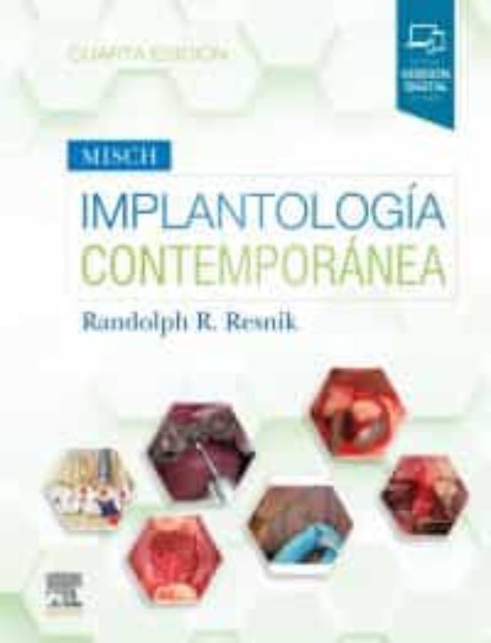 Misch. Implantología Contemporánea