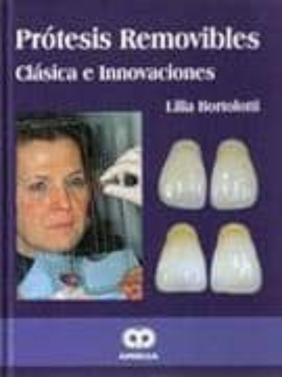 Protesis Removibles. Clasica E Innovaciones