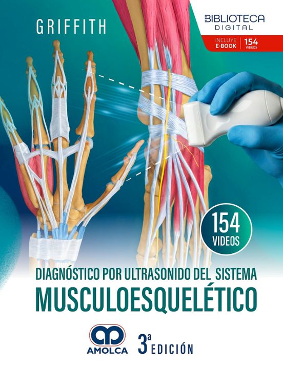 Diagnóstico por ultrasonido del sistema musculoesquelético