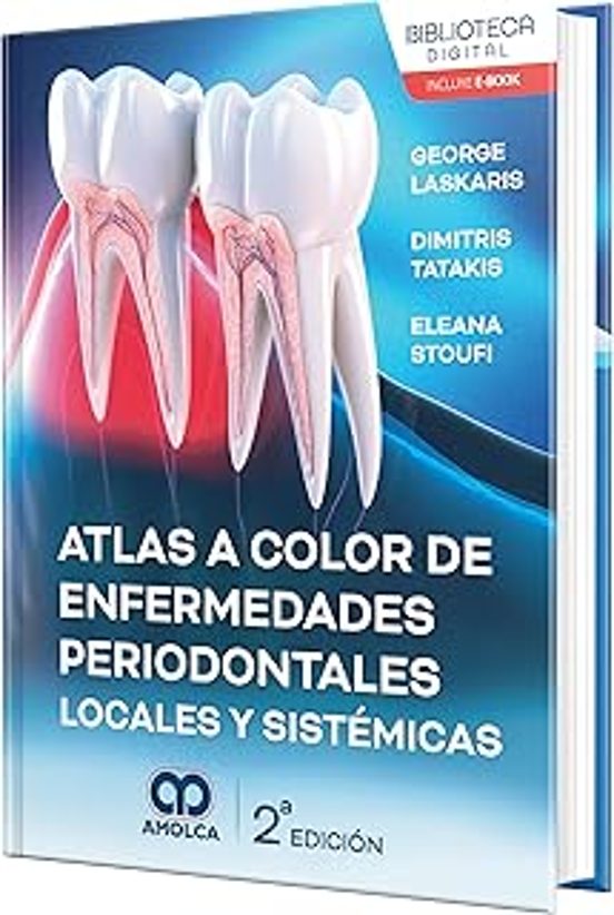 Atlas A Color De Enfermedades Periodontales Locales Y Sistémicas